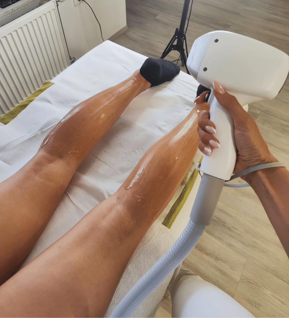 Diodni laser - IT-Fit estetski studio
